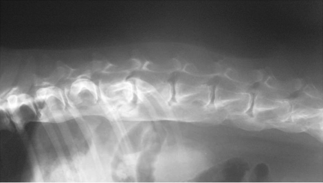 Röntgenfoto ernstige spondylose